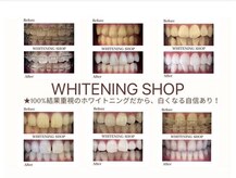 ホワイトニングショップ 宮古島店