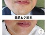 人気No.1【濃いヒゲ/カミソリ負けのお悩み】ヒゲ脱毛(首まで) 美肌パック付　