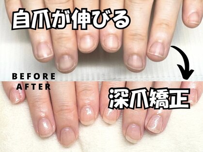 プラスワン(+1)の写真