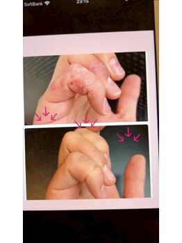 ケンビラク(Kenbiraku 健美楽)/プラズマシャワー自然治癒力促進