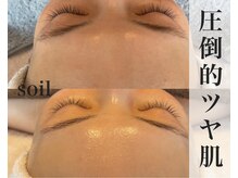 ソイル(Soil)の雰囲気(大人気!話題のワイコ水光肌ピーリングが豊田市で受けれます◎)