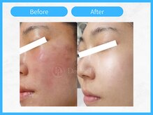 トウメイコガオ 横浜店/トウメイコガオでハーブ