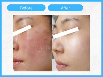 トウメイコガオ 横浜店/トウメイコガオでハーブ