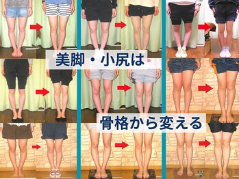 チャラク(charaku)の写真/美脚・小尻は真っ直ぐな土台から。AI分析と専門整体で、どんな服も着こなせる理想のシルエットへ。