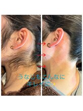 ココリ(CoCoRe)/うなじwax脱毛