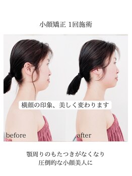 めい鍼灸院/小顔美人