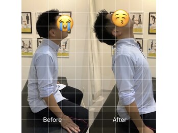 ナオル整体 三宮院(NAORU整体)/20代男性整体事例【肩凝り】
