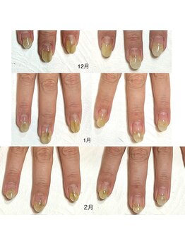 リンク(LINK)/３ヶ月での変化