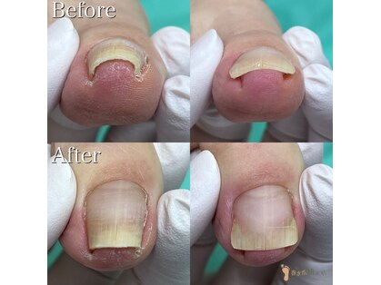 仙台巻き爪補正店の写真