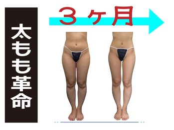 コンフィデンス 守口店(Confidence)/太ももの変化は3か月です♪