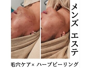 ルオント(LUONTO)/男性の肌悩みもご相談ください