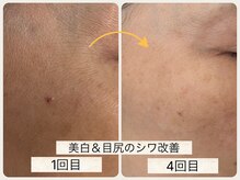 グランボヌール(grand bonheur)/【バクテリウムピール】