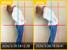 整体院 元 くまなん店/首こりと腰痛、姿勢改善で来院