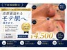 残り7名限定★40%OFF【メンズ毛穴洗浄】毛穴汚れゴッソリ取れます。