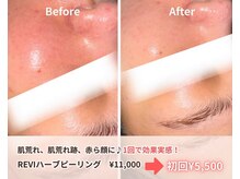 アクシア ビューティー サロン(AXSIA)