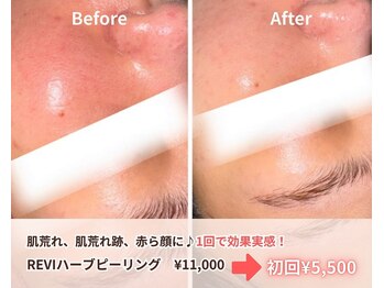 アクシア ビューティー サロン(AXSIA)の写真/メンズにも大人気!フェイシャル。肌が綺麗なだけで若々しくみえる、整った肌♪