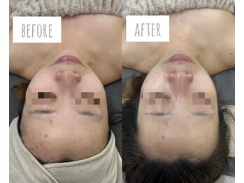 ラ ミュエル(La miel)/LHAピール