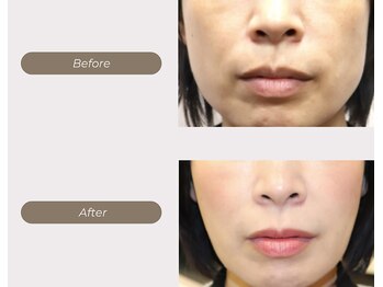 ムーンライズ(moonrise)/