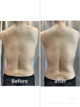 ラローゼ トウキョウ(LA ROSEE TOKYO)/最強痩身