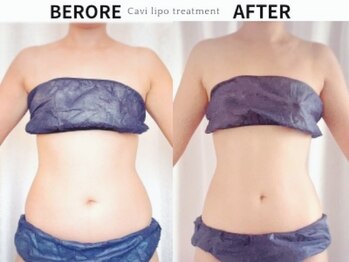 トレゾール(tresor)/★痩身★赤坂痩身エステ