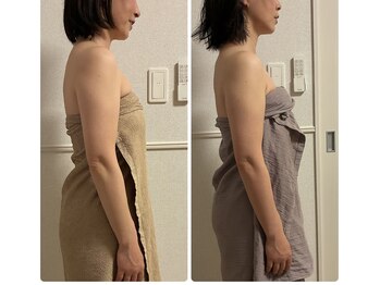 よす香/ビフォーアフター