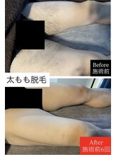 ヴァリエ(Varier)/Before after