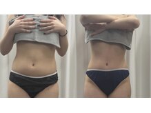 ラサロンホープ 西麻布(La.SALON HOPE)/