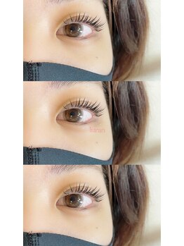 ルラン(luran)/ヘップバーン術後すぐ♪