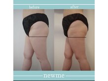 ニュウミー 諏訪本店(newme)/お客様ビフォーアフター