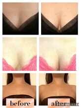 マンダ 田町(Manda)/バストのボリュームを増やします