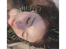 ベルシャルム 吉田院(Bell Charme)/吉田式美容鍼