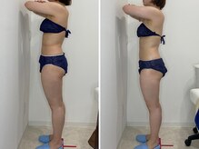 カプリス(CAPRiCE)/リンパドレナージュ