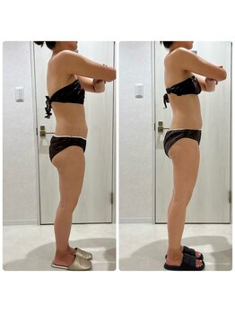 サロンドリュクス(salon de Luxe)/一回でのビフォーアフター