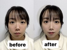 ミルク 学芸大学(MILK)/お客様before→after