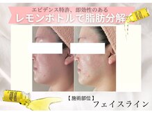 フェアリー 小松店/レモンボトル導入店♪