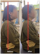 とばた整骨院/施術前後の姿勢変化
