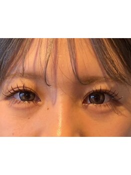 まつげのお悩み解決サロン