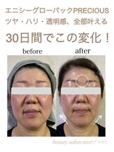 アルセ(arce)/エニシーグローパック