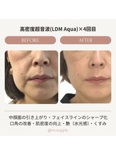 リサプリ(Re: Supple)/たるみケアで若々しく★