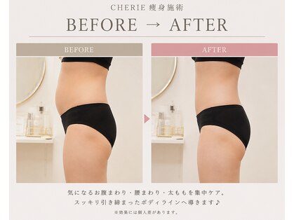 シェリー(CHERIE)の写真