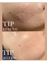 シャルム(charme)/どんなお肌もお任せください！