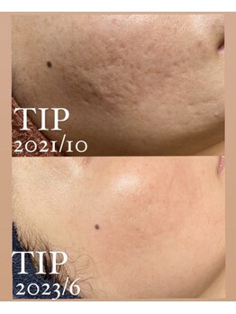 シャルム(charme)/どんなお肌もお任せください!