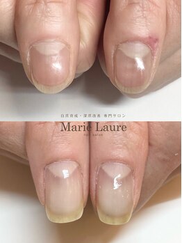 マリーロール 淀屋橋本店(Marie Laure)/自爪育成/深爪矯正/ネイルケア