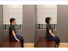 摂津本山駅前鍼灸整骨院/ビフォーアフターになります！