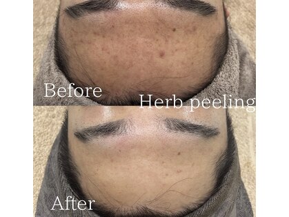 エムフロート(M float)の写真