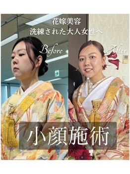 アティレ オオサカ(Attirer Osaka)/花嫁美容/小顔/ブライダル