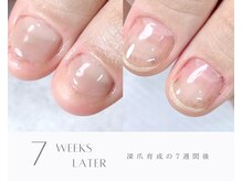 爪の状態に合わせた育成方法＋ホームケアで、ここまで成長♪