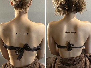 キュアフロウ 橿原店/深部加温で肩甲骨の位置が変わる