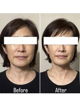 リタ(Rita.)/しっかり引き上げ小顔に