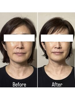 リタ(Rita.)/しっかり引き上げ小顔に